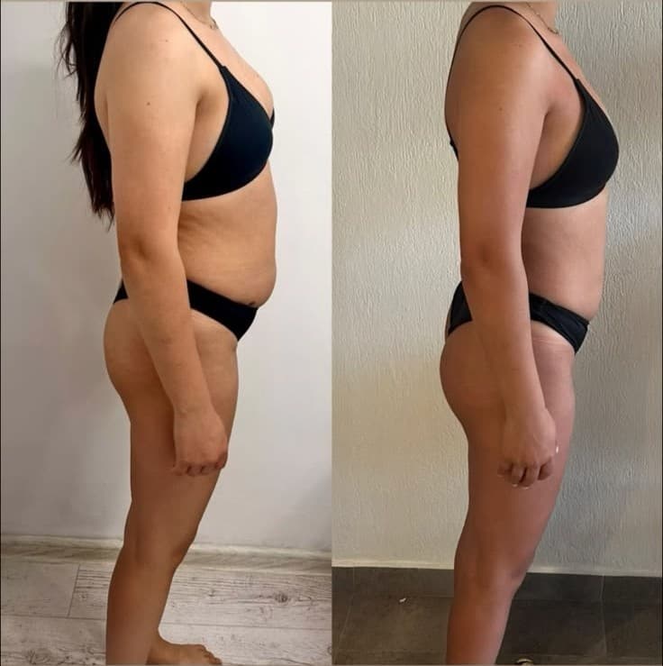 Transformare corporală clientă Marina Ruck #14