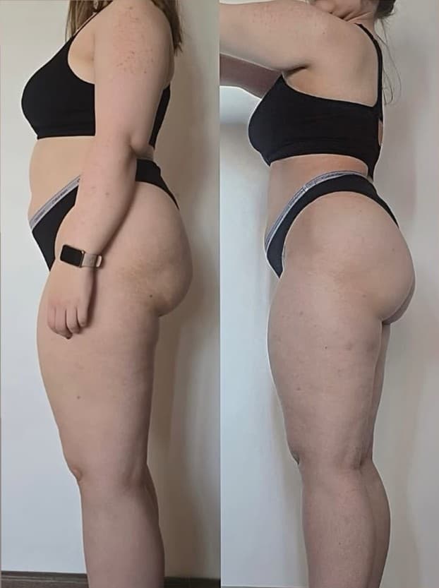 Transformare corporală clientă Marina Ruck #3